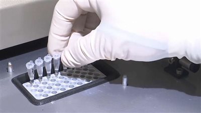 لماذا تختلف إجراءات المطارات  الاحترازية في  جدري القرود عن فيروس كورونا ؟ متحدث الصحة يوضح