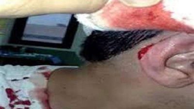 شاب سعودي يقطع أذن شقيقته.. والأمن يلقي القبض عليه