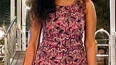 أسماء أبو اليزيد تثير الجدل بعد إصابتها في أنفها