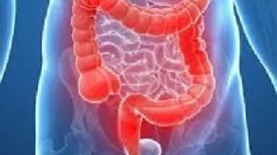 طرق للتعامل مع ألم سرطان القولون.. تعرف عليها
