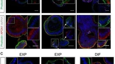 أثبتوا التجربة على 6 رجال.. دراسة تؤكد العثور على كورونا في السائل المنوي