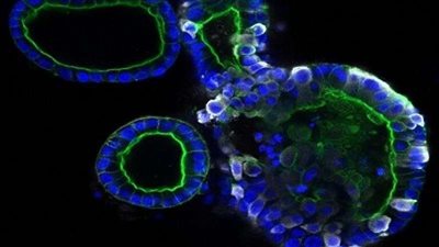 لميس الحديدي توجه رسالة تحذيرية من كورونا.. فيديو