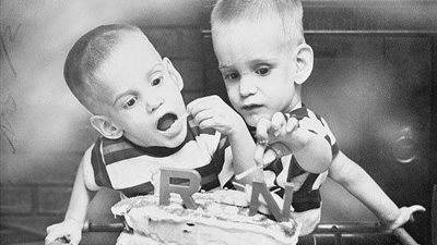 جراحة معقدة.. فصل توأم برازيلي ملتصق في الرأس بمساعدة الواقع الافتراضي