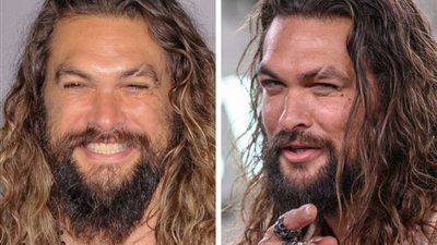 الرجل ذو الندبة أكثر جاذبية للنساء من الوسيم.. الأسباب غريبة