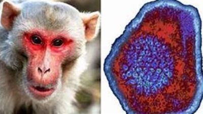 شاهد| انتشار جدري القرود في جسد رجل.. كادت تُبتر أنفه لهذا السبب