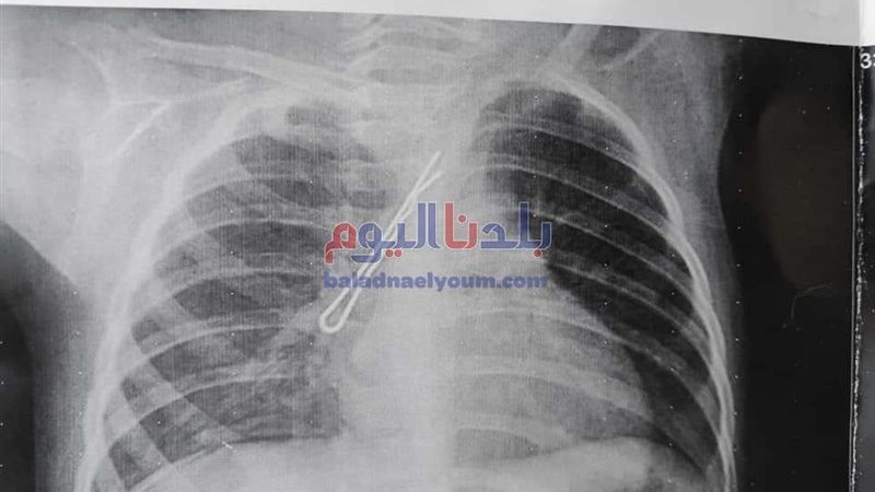 بلدنا اليوم