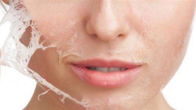 أضرار تقشير الوجه..  تعرّف عليها