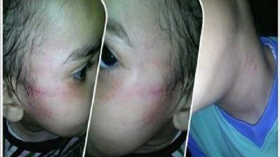 تضامن الإسكندرية تنفي تعرض طفل بدار الرشاد للضرب على الوجه