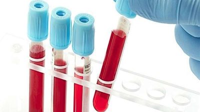 كارثة.. العلماء: ثلث نتائج اختبارات الـ 