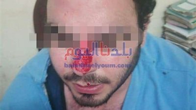 الاعتداء على طبيب أثناء تأدية مهام عمله بمستشفى جامعة طنطا