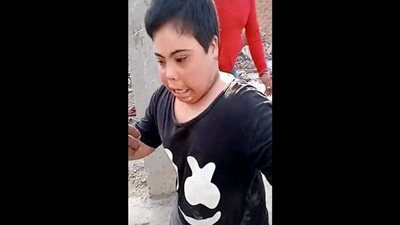 بالفيديو.. شباب يطلقون كلب حراسة على طفل من ذوي الإعاقة