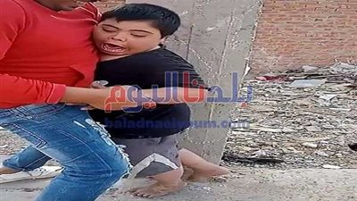 شباب يعتدون على طفل من أصحاب الهمم بكلب حراسة .. فيديو وصور
