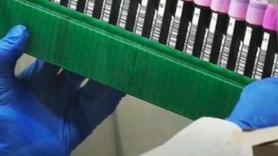 شاهد.. إصابات كورونا عالميا تلامس الـ 6 ملايين.. وهذا عدد الوفيات