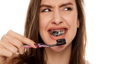 علاقة الفحم وتبييض الأسنان.. هل صار حل أم مشكلة ؟