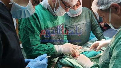 فريق طبى بمستشفى جامعة طنطا ينجح في استخراج سيخ حديدي من بطن طفل