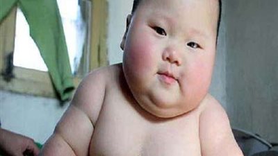 احذري .. السمنة تصيب طفلك بالشيخوخة المبكرة