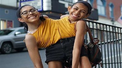 فتاتان ملتصقتان تتعلمن قيادة السيارة بعد بلوغهن 18 عامًا.. شاهد