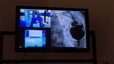 رسميا.. مصر تنفرد بأحدث أجهزة التزامن القلبي