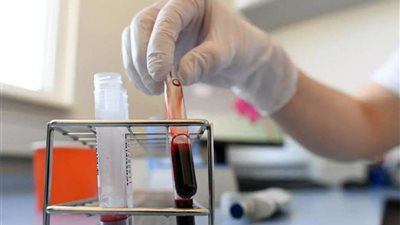 تعرف على فترة صلاحية البلازما وأفضل فترة لاستخلاصها (فيديو)