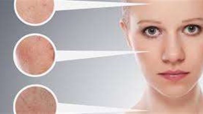 أفضل الوصفات للعناية بالبشرة الدهنية