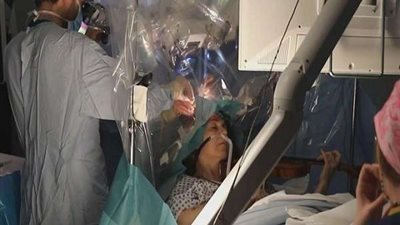 لأول مرة في المنوفية.. إجراء عملية في المخ بمستشفى جراحة المخ والأعصاب بشبين الكوم