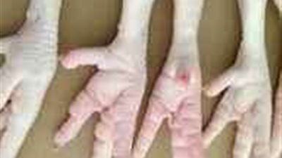 شابة تدخل موسوعة جينيس برجول الدجاج .. تفاصيل