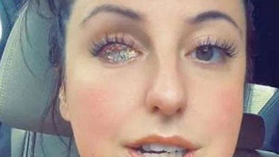 أمريكية تثير الجدل بعينها المرصعة بالماس.. والسبب مؤثر