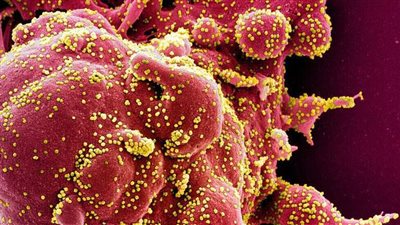 هام.. عادات خاطئة لن تتوقعها تزيد فرصة إصابتك بفيروس كورونا