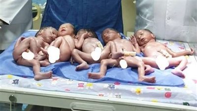 تعرف على أغرب ولادة قيصرية تنتهي بإنجاب 5 توأم