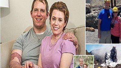 ذهبا ليحتفلا بالزواج.. زوجان يتعرضان لحروق بالغة بسبب ثوران بركان (صور)