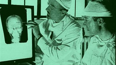 متلازمة أليس .. أغرب الأمراض النفسية في يومها العالمي