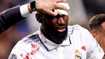 رغم الإصابة.. روديجر جاهز للمشاركة في كلاسيكو الأرض