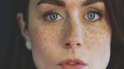 بسبب الشامة.. 5 علامات تكشف الإصابة بـ