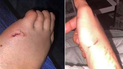 تعدى عليها زوجها.. سيدة تستغيث بأمير عسير لـ تأمين سكن ونفقة لها