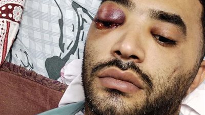 بعد مقتل ابنه بيومين.. وفاة والد عريس المحلة