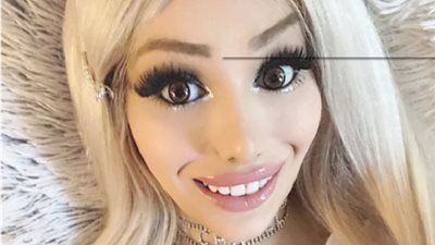 هوس عمليات التجميل يحول 