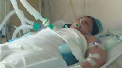 الموت يصارع طفلة 4 سنوات بعد تقليد شخصية كرتونية