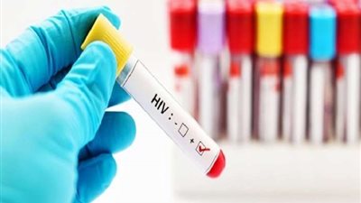 صفر في 2023.. خطة بريطانية تقضي على فيروس الإيدز خلال شهور