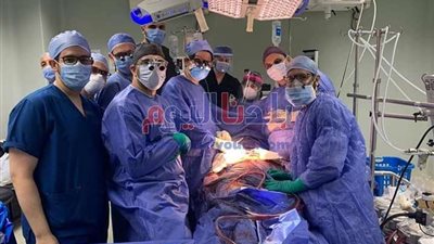 إنقاذ حياة مريضة تعاني من انشطار الشريان الأورطي بالمنوفية