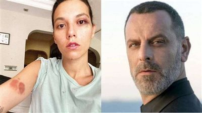 بسبب ضربه حبيبته..  حبس ممثل تركي شهير 13 عاماً