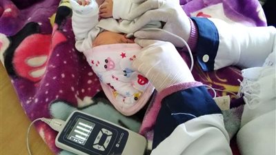 الصحة: فحص 3 ملايين و856 ألف طفل ضمن المبادرة الرئاسية للكشف المبكر وعلاج ضعف وفقدان السمع