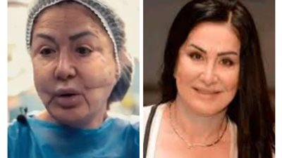 لعلاج التشوهات..  خضوع وفاء سالم لعملية تجميل جديدة