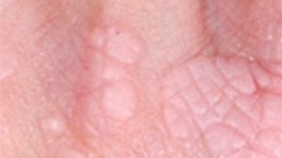 كل ما تود معرفته عن فيروس 