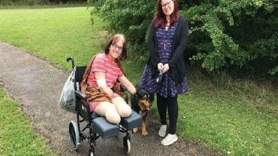 نهاية مأساوية.. سيدة تفقد أطرافها والسبب 