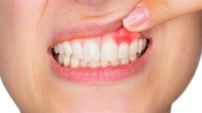 تأثير السكري على