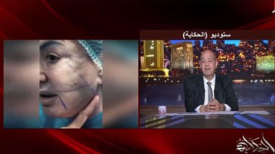 أنا طالعة بدون أي فلاتر.. وفاء سالم تكشف تفاصيل جديدة بعد تشوهات وجهها