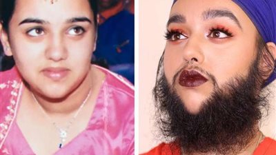 بـ شنب ودقن.. فتاة تتحدى معايير الجمال وتدخل موسوعة جينيس «صور»