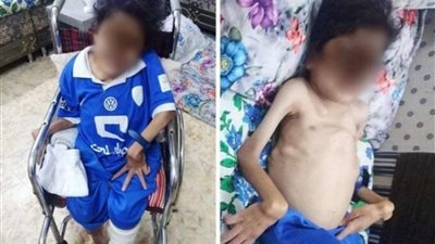 في مكة المكرمة.. مرض غامض يتسبب في وفاة ثلاثة بنات من أسرة واحدة