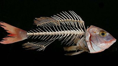 بالفيديو.. استئصال يد عجوز بسبب شوكة سمكة