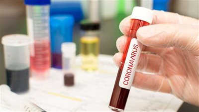 بريطانيا تُعلن أخبار سارة عن علاج فيروس كورونا